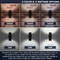 Luxrite Dusk to Dawn LED Wall Lights 10in up or Up and Down Light 3CCT 3000K-5000K 12/15/18W IP65 ETL, 2PK LR40336-2PK - alternate 7